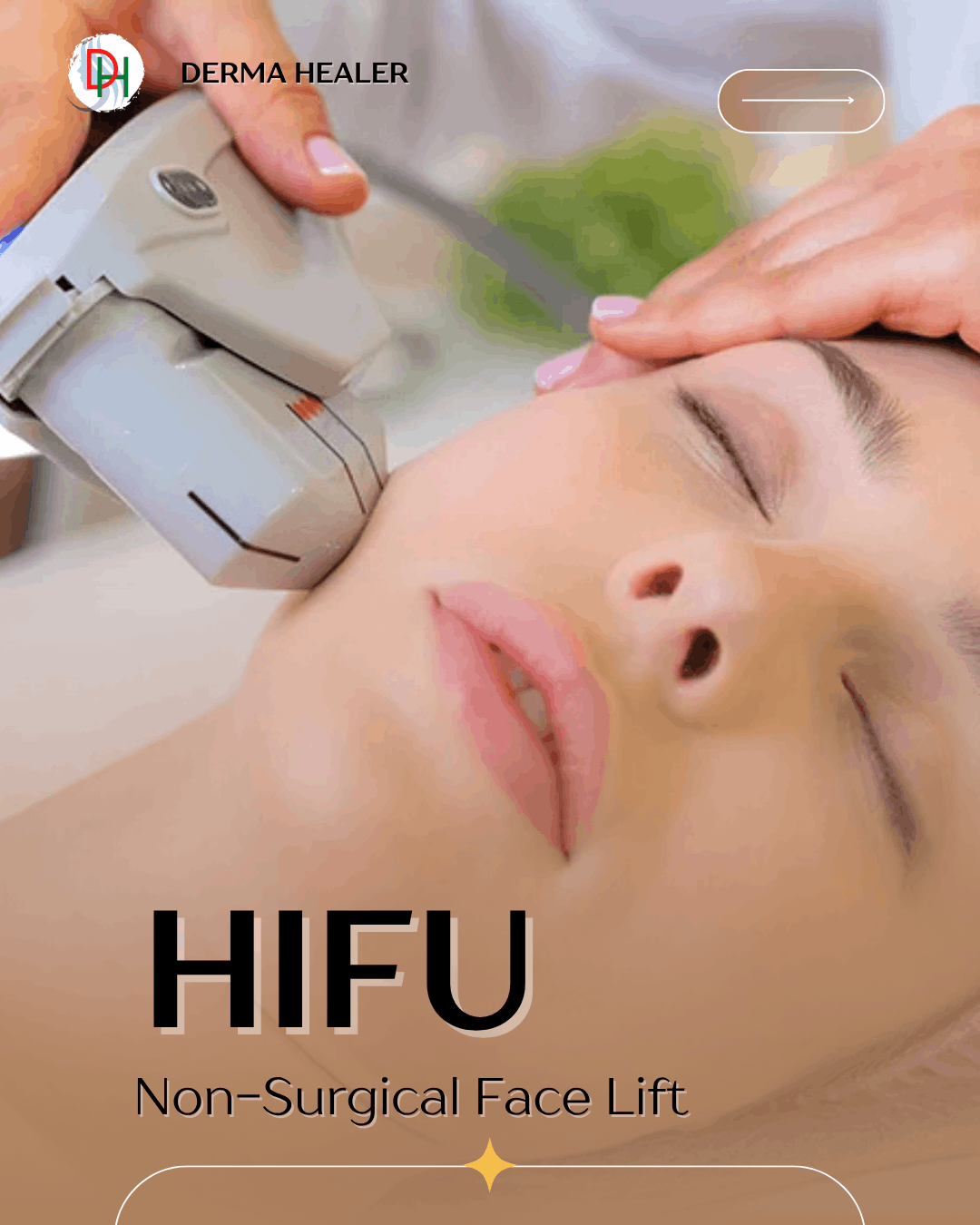 Reclaim Your Youth Naturally: The Ultimate Guide to HIFU Treatment at Derma Healer India