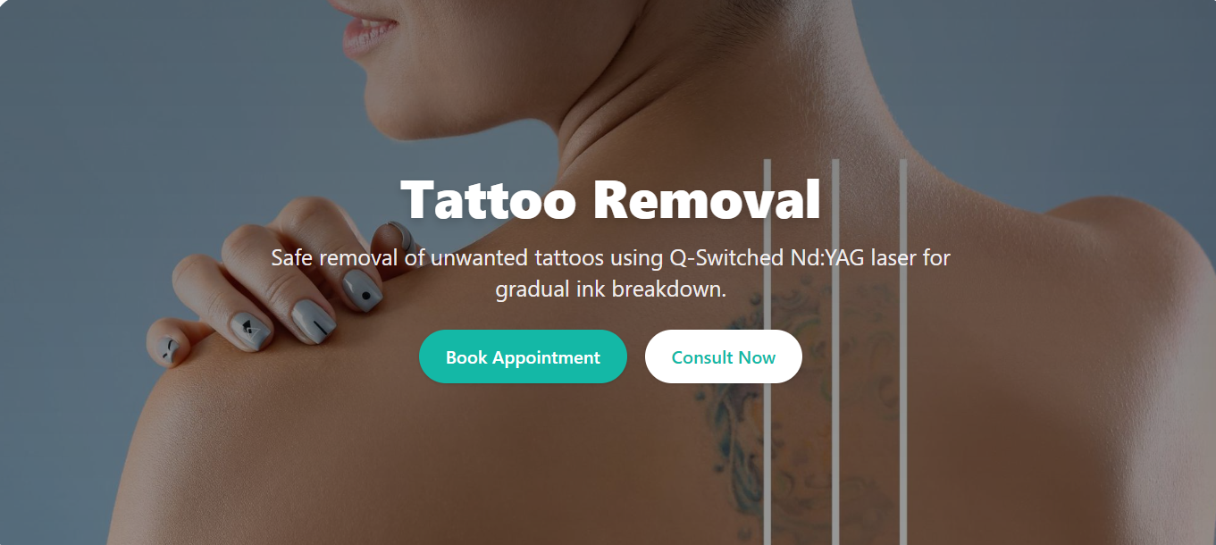 Clear Your Ink, Right Here in Siwan: Safe & Advanced Tattoo Removal at Derma Healer India